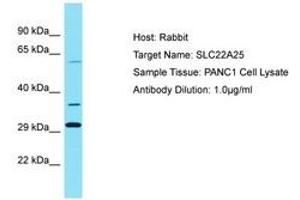 Image no. 1 for anti-Solute Carrier Family 22, Member 25 (SLC22A25) (AA 271-320) antibody (ABIN6750804)