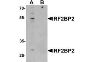 Image no. 2 for anti-Interferon Regulatory Factor 2 Binding Protein 2 (IRF2BP2) (C-Term) antibody (ABIN1450118)