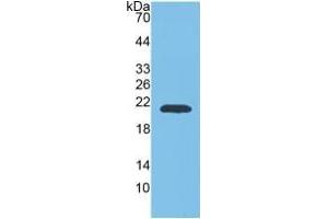 Image no. 5 for Matrix Metallopeptidase 9 (Gelatinase B, 92kDa Gelatinase, 92kDa Type IV Collagenase) (MMP9) ELISA Kit (ABIN6730943)