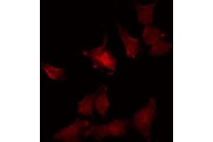 Image no. 1 for anti-Potassium Channel, Subfamily K, Member 4 (KCNK4) (C-Term) antibody (ABIN6257437)