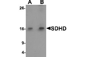 Western blot analysis of SDHD in EL4 cell lysate with SDHD antibody at (A) 1 and (B) 2 µg/mL.