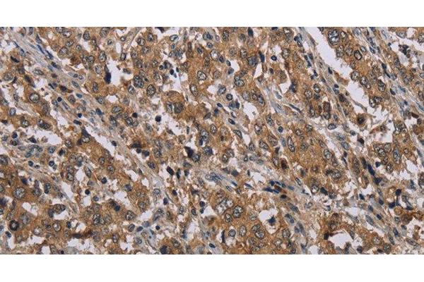 MAL antibody