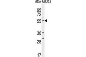 Image no. 3 for anti-Cytochrome P450, Family 2, Subfamily A, Polypeptide 7 (CYP2A7) (AA 128-15), (Middle Region) antibody (ABIN951781)