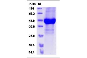 Image no. 1 for Nephroblastoma Overexpressed (NOV) (AA 1-353) protein (His tag) (ABIN2008885)