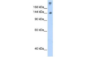 Image no. 3 for anti-Splicing Factor 3b, Subunit 1, 155kDa (SF3B1) (N-Term) antibody (ABIN629906)