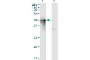 anti-Armadillo Repeat Containing 6 (ARMC6) (AA 1-476) antibody