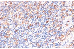 Immunohistochemistry of paraffin-embedded Human tonsil using CYBA Polyclonal Antibody at dilution of 1:100 (40x lens).