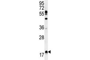 RHEB Antikörper  (AA 104-134)