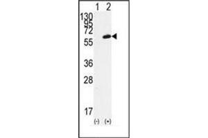 Image no. 3 for anti-Gardner-Rasheed Feline Sarcoma Viral (V-Fgr) Oncogene Homolog (FGR) (AA 11-40), (N-Term) antibody (ABIN359981)
