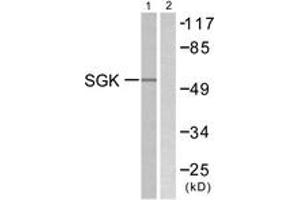Image no. 1 for anti-serum/glucocorticoid Regulated Kinase 1 (SGK1) (AA 41-90) antibody (ABIN1532486)