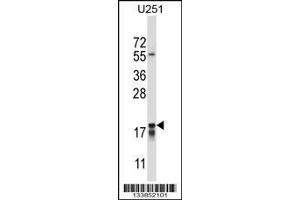 Image no. 1 for anti-Cancer/testis Antigen 2 (CTAG2) (AA 122-149) antibody (ABIN657689)