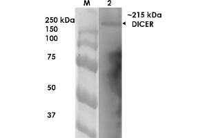 Western Blot analysis of Rat Brain Membrane showing detection of ~215 kDa Dicer protein using Mouse Anti-Dicer Monoclonal Antibody, Clone S167-7 .