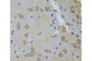 Immunohistochemistry of paraffin-embedded Mouse brain using Gm13125 Polyclonal Antibody at dilution of 1:100 (40x lens).