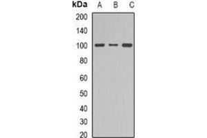 Image no. 2 for anti-Dynamin 1 (DNM1) (C-Term) antibody (ABIN2957553)