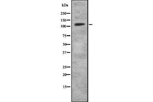 Image no. 1 for anti-MKL/myocardin-Like 2 (MKL2) (Internal Region) antibody (ABIN6263266)