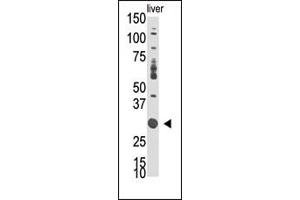 Western Blotting (WB) image for anti-Docking Protein 5 (DOK5) (N-Term) antibody (ABIN2160677)