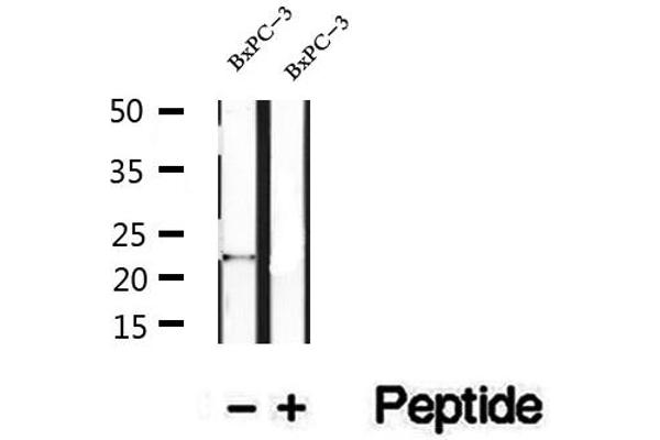 REEP6 antibody  (C-Term)