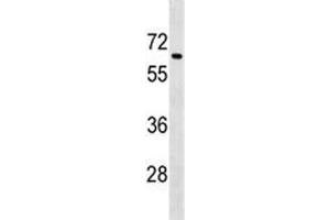 Image no. 2 for anti-Transforming Growth Factor, beta Receptor II (70/80kDa) (TGFBR2) (AA 548-575) antibody (ABIN3029225)