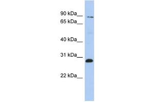 Image no. 1 for anti-Zinc Finger Protein 148 (ZNF148) (Middle Region) antibody (ABIN2775906)