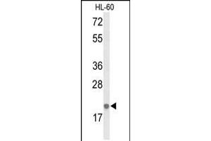 Image no. 1 for anti-Interleukin 26 (IL26) (AA 88-115) antibody (ABIN5532604)