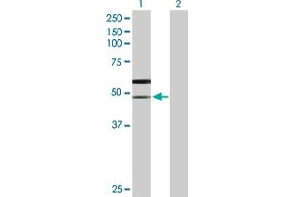 SLC38A3 Antikörper  (AA 1-504)