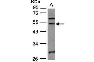 Image no. 2 for anti-NOP2/Sun Domain Family, Member 6 (NSUN6) (Center) antibody (ABIN2856494)