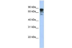 Image no. 1 for anti-Dihydropyrimidinase-Like 3 (DPYSL3) (Middle Region) antibody (ABIN633808)