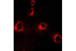 Image no. 2 for anti-Killer Cell Immunoglobulin-Like Receptor, Two Domains, Long Cytoplasmic Tail, 3 (KIR2DL3) antibody (ABIN2966504)