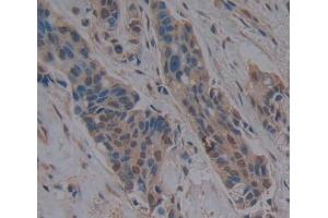 Image no. 1 for anti-High Mobility Group Box 3 (HMGB3) (AA 14-176) antibody (ABIN5013696)