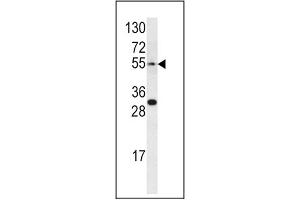 Image no. 1 for anti-Endothelin Receptor Type A (EDNRA) (AA 132-162) antibody (ABIN452933)
