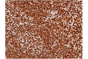 Image no. 13 for anti-Mast/stem Cell Growth Factor Receptor (KIT) (pTyr721) antibody (ABIN6256004)