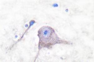 Image no. 2 for anti-Synaptosomal-Associated Protein, 25kDa (SNAP25) antibody (ABIN271818)