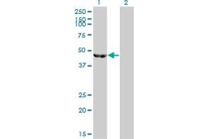 Image no. 3 for anti-Enolase 3 (Beta, Muscle) (ENO3) (AA 228-277) antibody (ABIN560744)