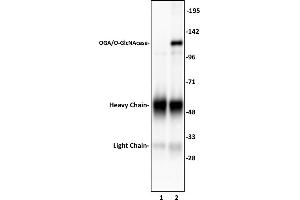 Image no. 2 for anti-Meningioma Expressed Antigen 5 (Hyaluronidase) (MGEA5) (N-Term) antibody (ABIN6972461)
