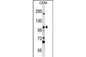 Image no. 1 for anti-Minichromosome Maintenance Deficient 4 (MCM4) (AA 637-665), (C-Term) antibody (ABIN5533344)