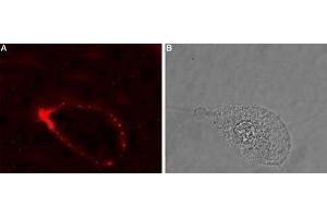 Expression of GlyRα4 in human retinal epithelium (ARPE-19) - Cell surface detection of GlyRα4 in intact living human ARPE-19 cells.