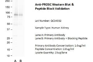 PROSC anticorps  (C-Term)