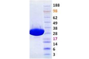 Image no. 1 for P21 Protein (Cdc42/Rac)-Activated Kinase 7 (PAK7) (Transcript Variant 2) (Active) protein (ABIN2728183)