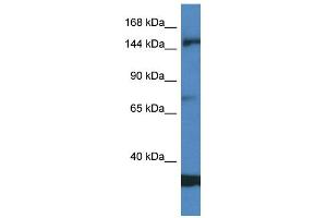 Image no. 2 for anti-Eukaryotic Translation Initiation Factor 5B (EIF5B) (Middle Region) antibody (ABIN2788862)