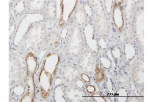 Image no. 3 for anti-Calcyphosine (CAPS) (AA 1-189) antibody (ABIN1327676)
