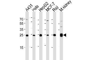 Image no. 1 for anti-Adenylate Kinase 4 (AK4) (AA 119-153) antibody (ABIN1944856)