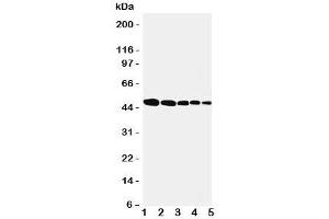 Western blot testing of Flotillin 1 antbody; Lane 1: rat lung;  2: (r) brain;  3: (r) ovary;  4: human SMMC-7721;  5: (h) MFC-7 cell lysate.