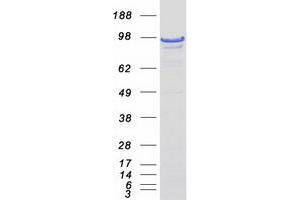 Image no. 1 for Death-Domain Associated Protein (DAXX) (Transcript Variant 2) protein (Myc-DYKDDDDK Tag) (ABIN2719229)