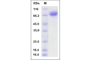 Image no. 1 for Basal Cell Adhesion Molecule (Lutheran Blood Group) (BCAM) (AA 1-543) (Active) protein (His tag) (ABIN2009334)