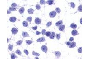 Image no. 2 for anti-G Protein-Coupled Receptor 45 (GPR45) (Cytoplasmic Domain) antibody (ABIN1048831)
