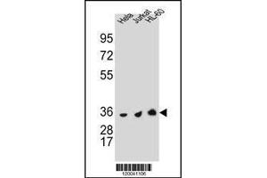 Image no. 1 for anti-Thymidylate Synthetase (TYMS) (AA 265-294), (C-Term) antibody (ABIN1881964)