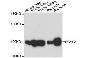 Image no. 1 for anti-SCY1-Like 2 (SCYL2) antibody (ABIN6147463)