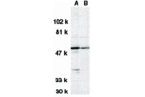 Image no. 3 for anti-serine/threonine Kinase 17a (STK17A) (N-Term) antibody (ABIN6655344)
