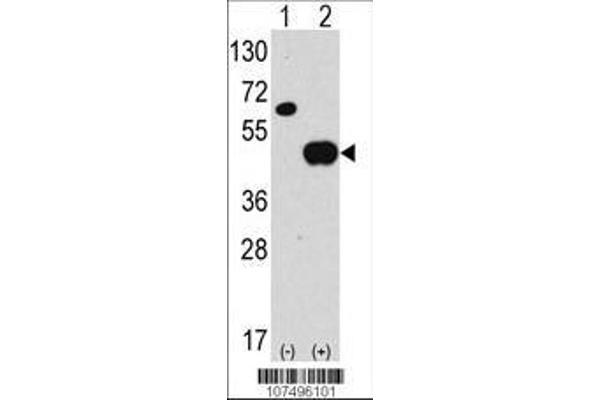 anti-Autophagy related 4B Cysteine Peptidase (ATG4B) (AA 16-45), (N-Term) antibody