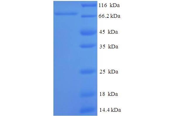DHX9 Protein (AA 325-840, partial) (His-SUMO Tag)